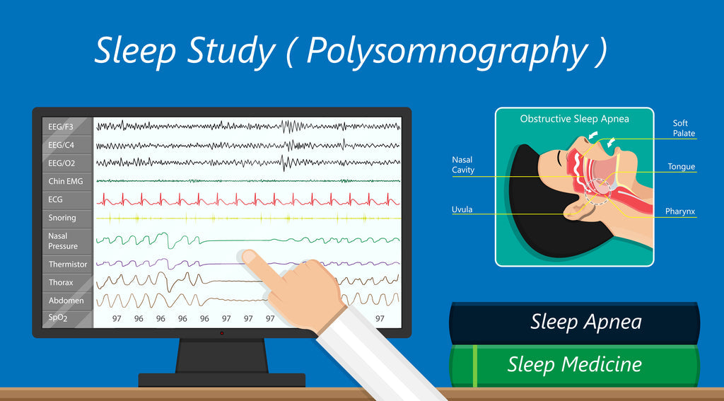 Diagnosing Sleep Apnea and Snoring: The Role of the Sleep Study