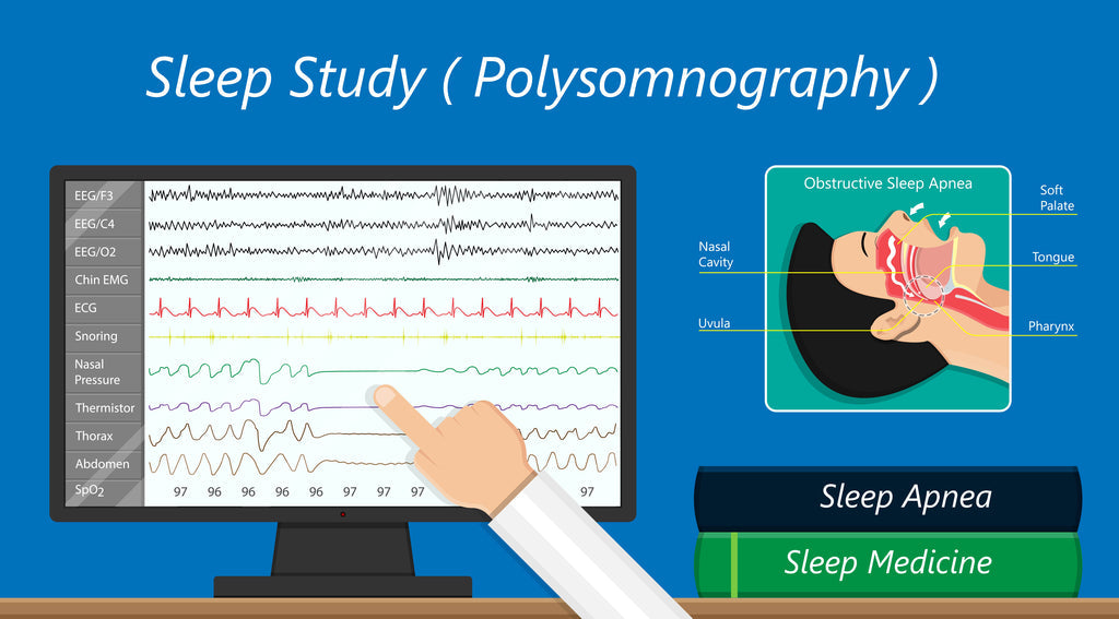 Sleep study polysomnography