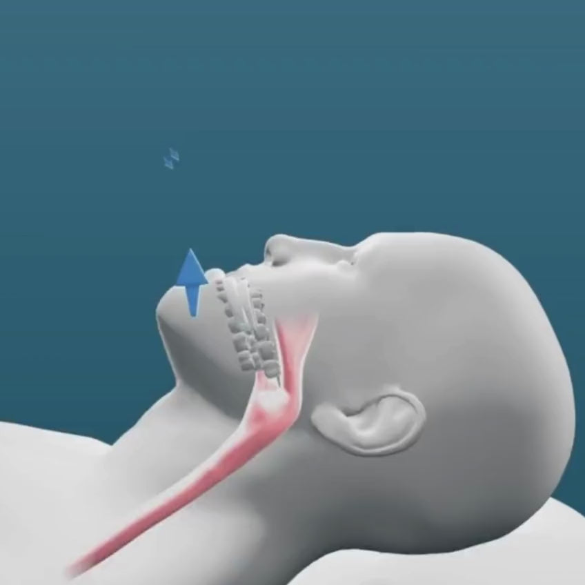 Snore No More Bundle